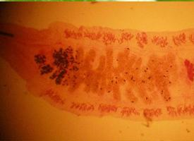 Foto: Fasciola hepática china